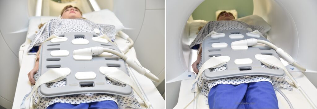 MRI thigh positioning photo