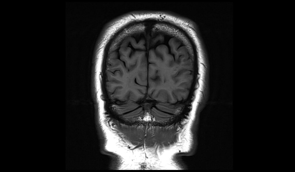 PLAN BRAIN IMAGE T1 Cor - Mrimaster