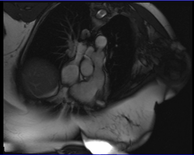 MRI anatomy brain axial image 3