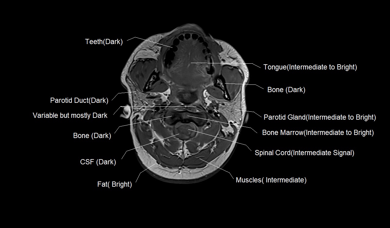 T1 vs T2 MRI | T1and T2 MRI image comparison