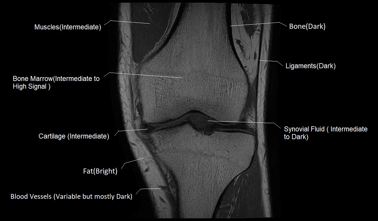 T1 vs T2 MRI | T1and T2 MRI image comparison