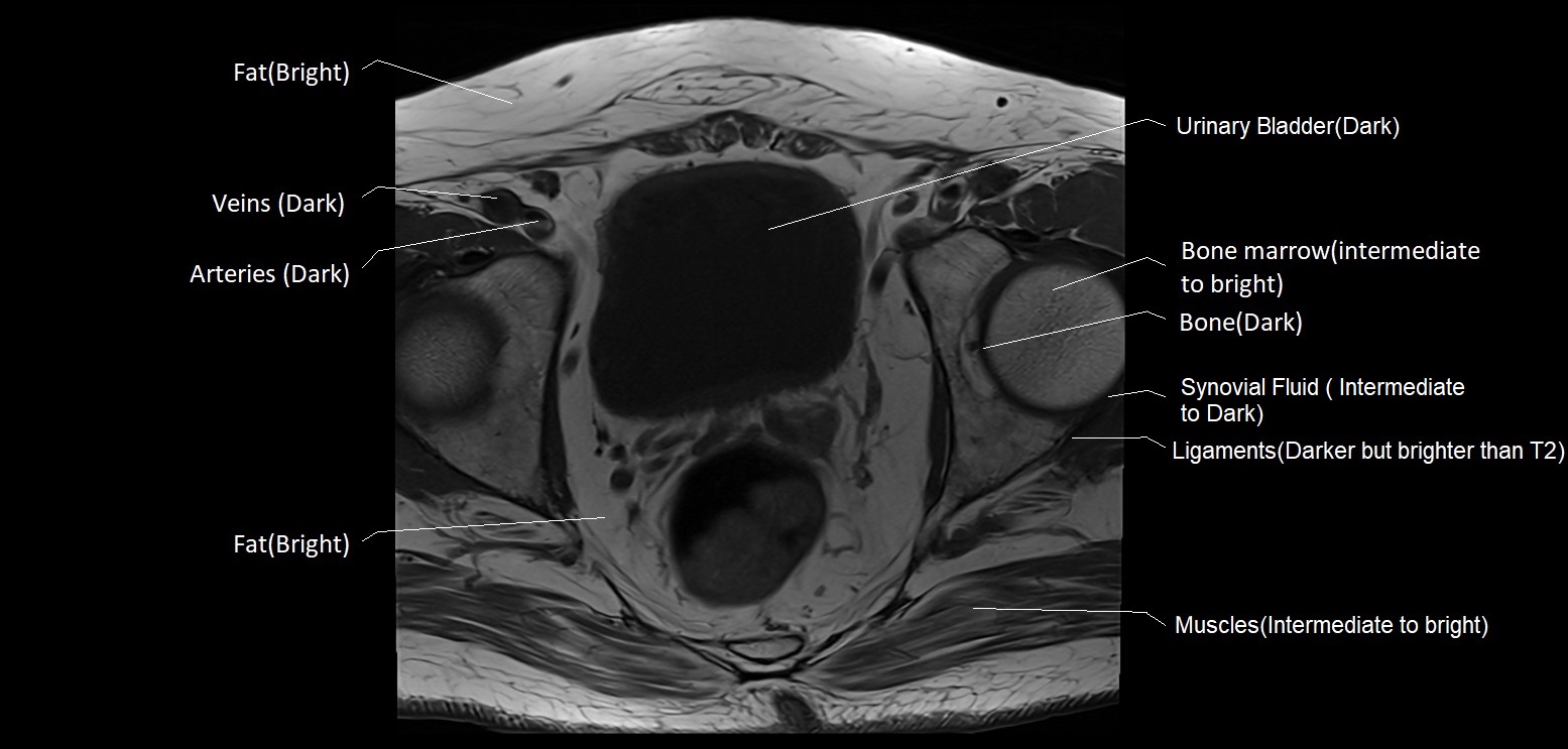 T1 vs T2 MRI | T1and T2 MRI image comparison