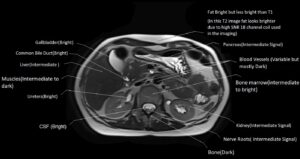 T1 vs T2 MRI | T1and T2 MRI image comparison