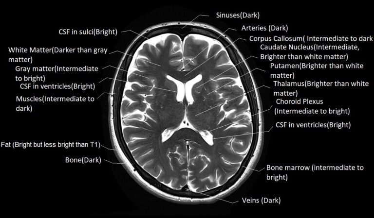 T1 vs T2 MRI | T1and T2 MRI image comparison