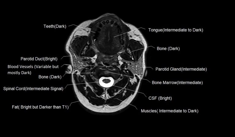 T1 vs T2 MRI | T1and T2 MRI image comparison