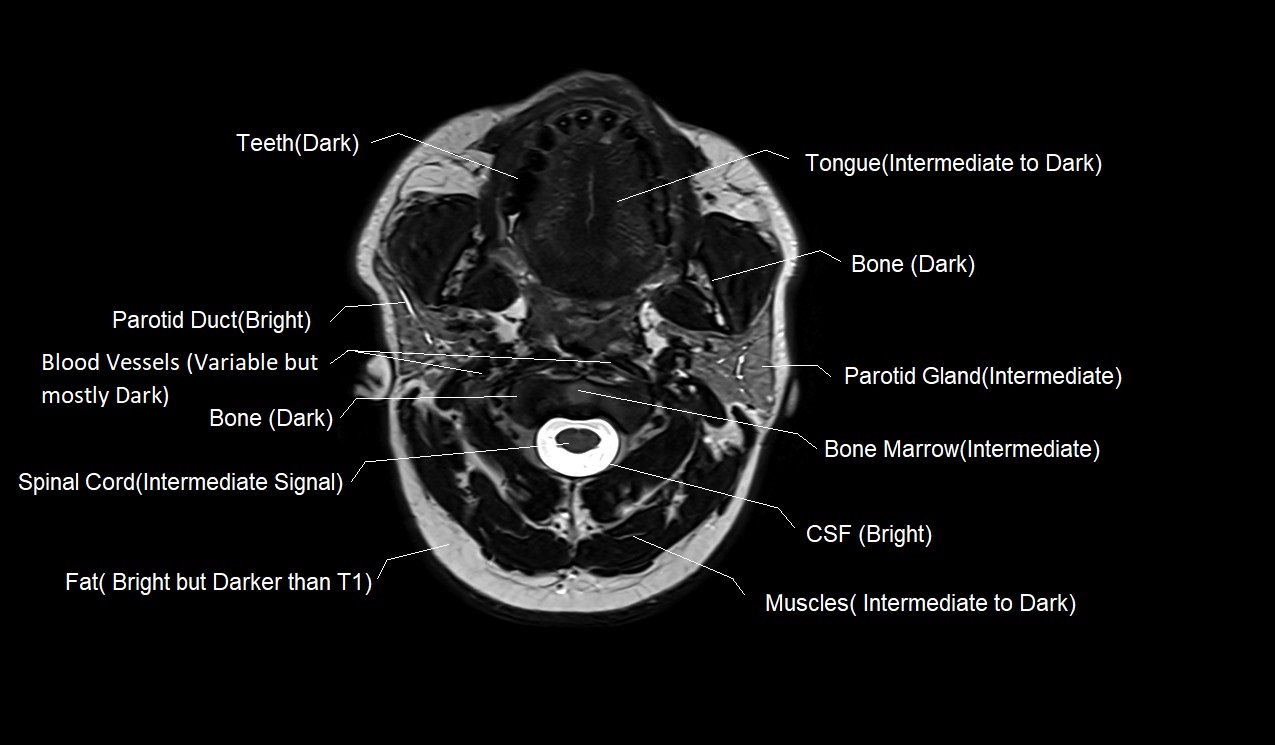 T1 Vs T2 Mri 