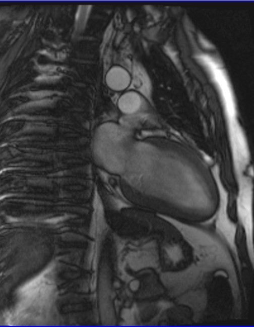 MRI anatomy brain axial image 2