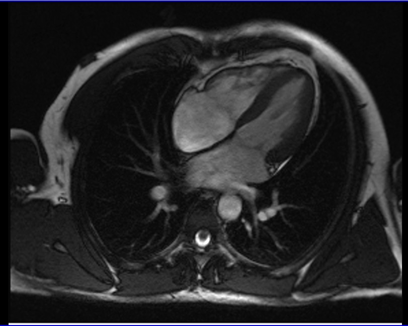 MRI anatomy brain axial image 4