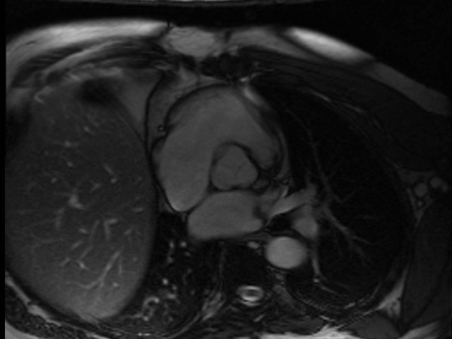 MRI anatomy brain axial image 3