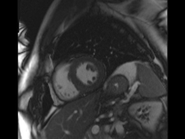 MRI anatomy brain axial image 1