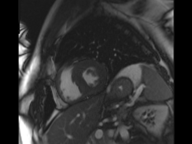 MRI anatomy brain axial image 8