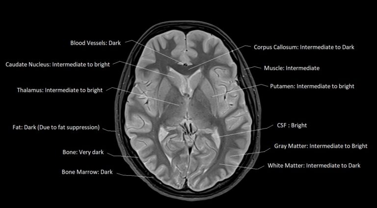 FLAIR vs STIR MRI | FLAIR vs STIR MRI image comparison