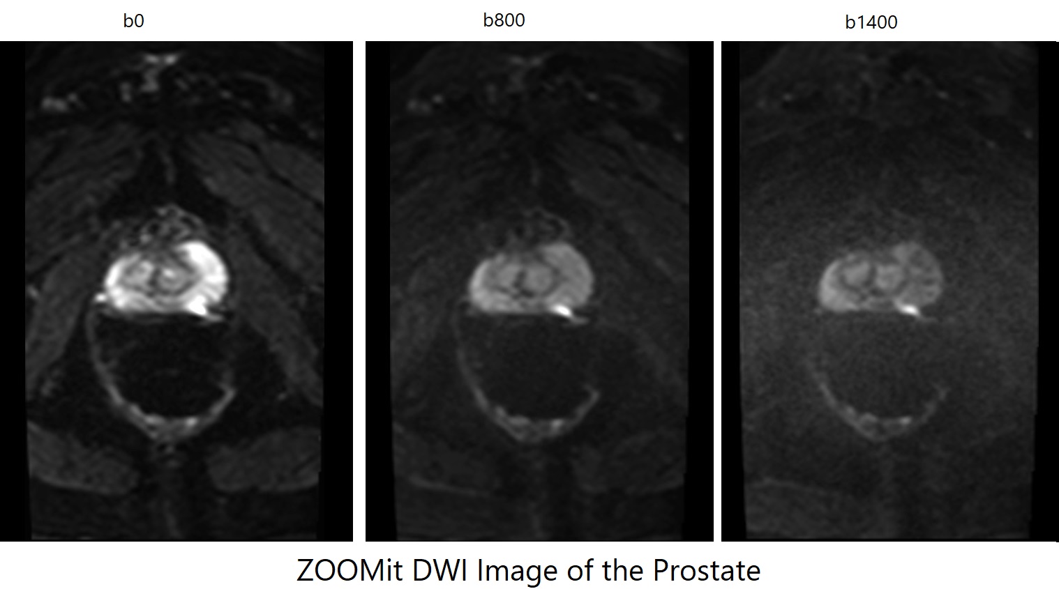 ZOOMit DWI | ZOOMit DWI Physics and Applications