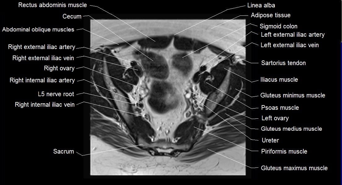 Female pelvis anatomy | Free axial cross sectional anatomy of female pelvis