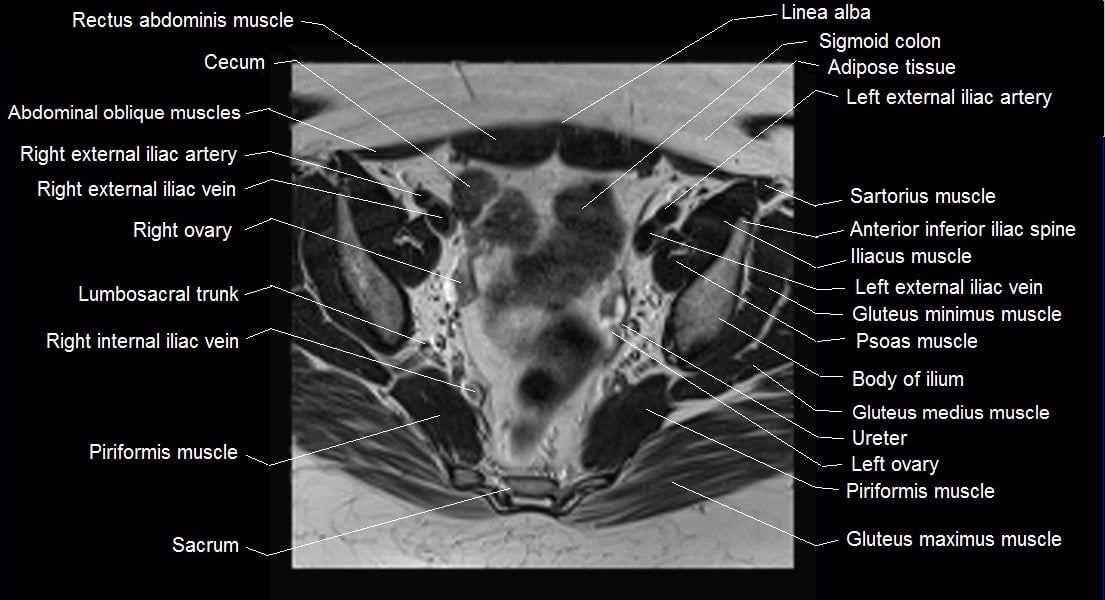 Female pelvis anatomy | Free axial cross sectional anatomy of female pelvis