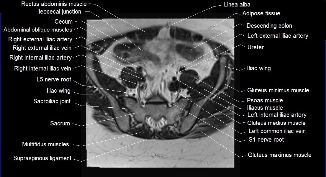 Pelvis: Anatomy [+ Labeled Diagram]