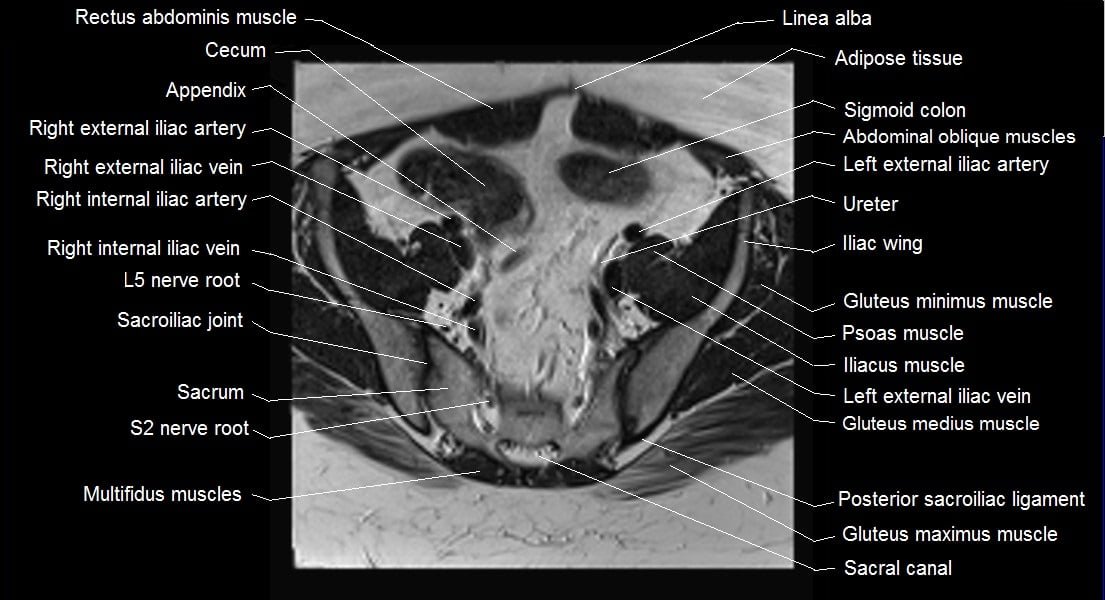 mri female pelvis anatomy axial image 7