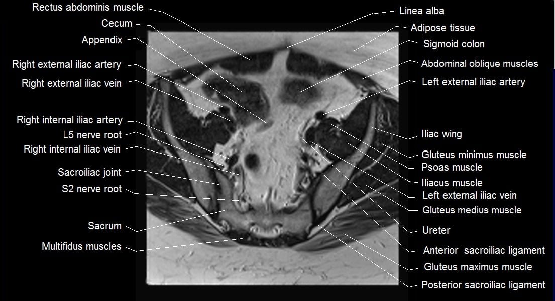 mri female pelvis anatomy axial image 8