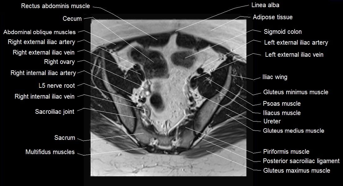 mri female pelvis anatomy axial image 9