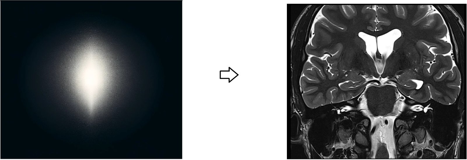 K- space MRI image