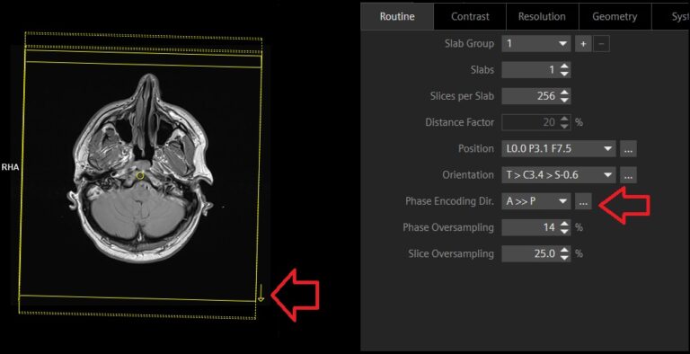 Phase encoding in MRI | MRI Phase encoding direction