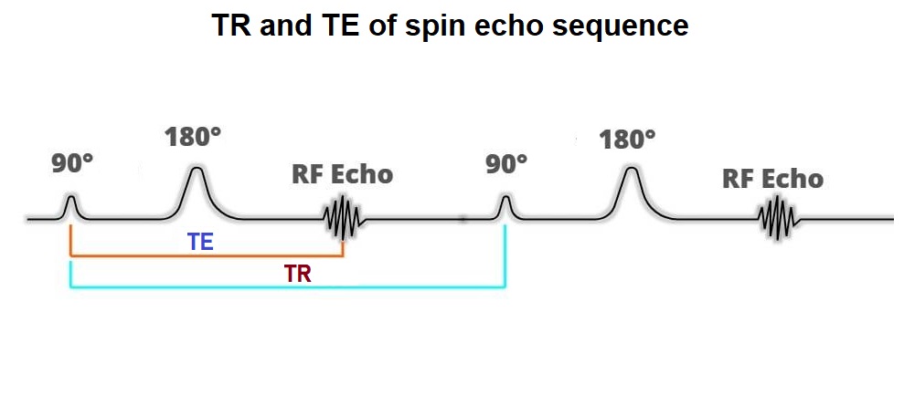 TR and TE in MRI | TR (repetition time),TE (echo time) and image contrast