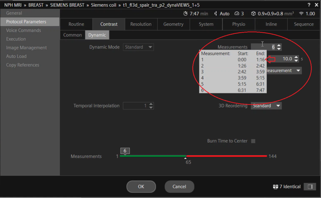 Temporal Resolution in MRI | How to Calculate Temporal Resolution