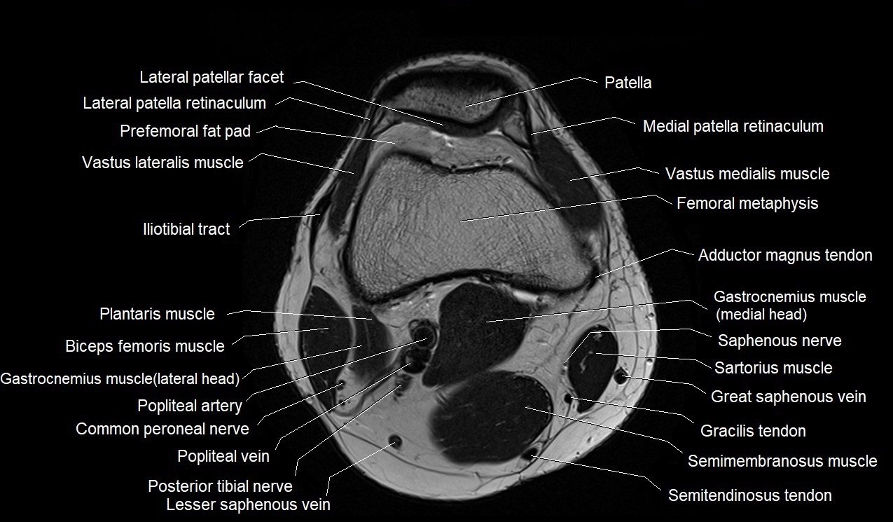 knee-anatomy-mri
