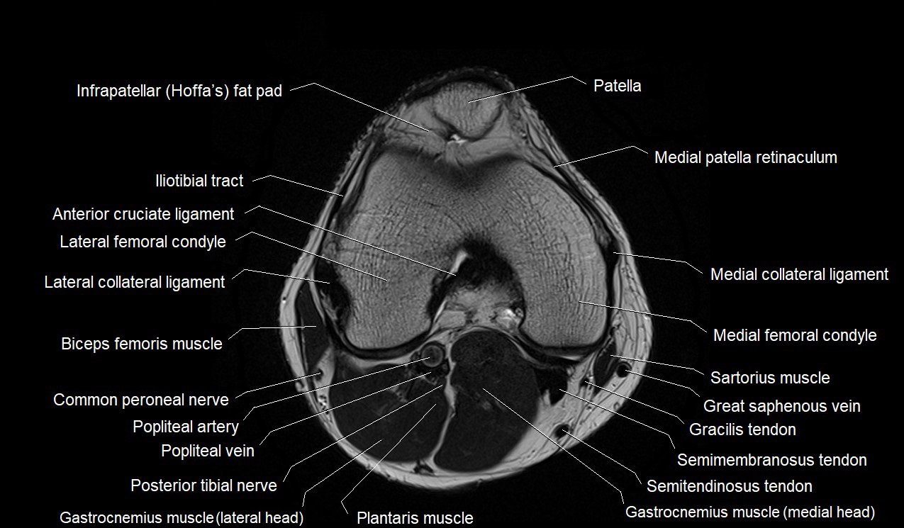 Knee Muscle Anatomy Mri Atlas Of Knee Mri Anatomy W Radiology