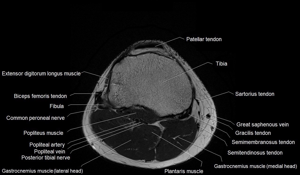 Anatomy Knee Mri Knee Muscle Anatomy Mri Atlas Of Knee MRI Anatomy