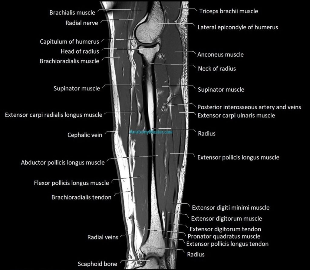 MRI 3T sagittal cross sectional anatomy image