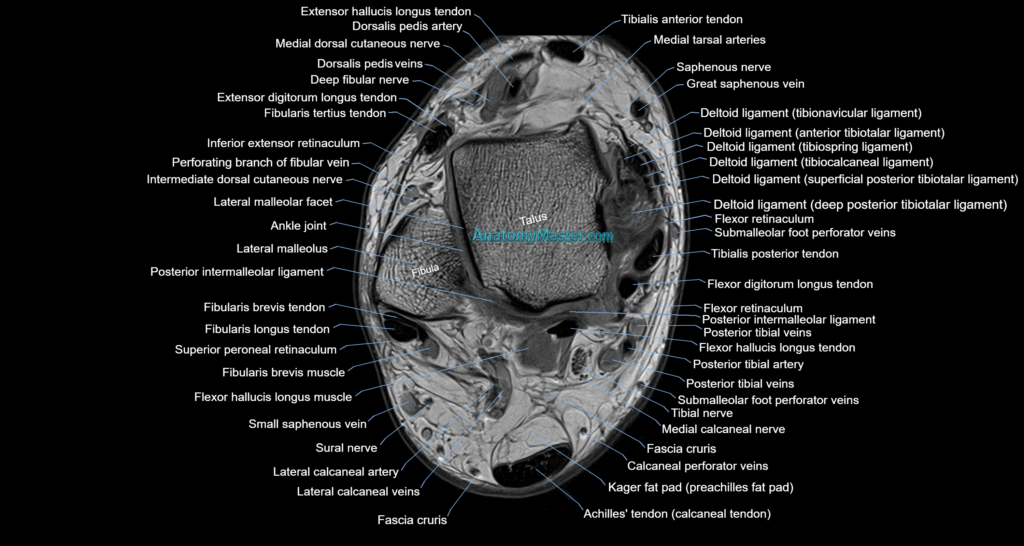 Ankle axial anatomy 3T MRI images