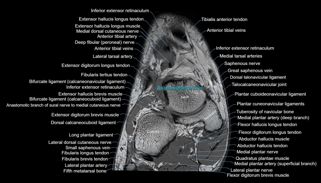 Ankle coronal anatomy 3T MRI images