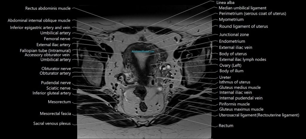 Axial cross sectional anatomy of female pelvis (MRI 3T) image