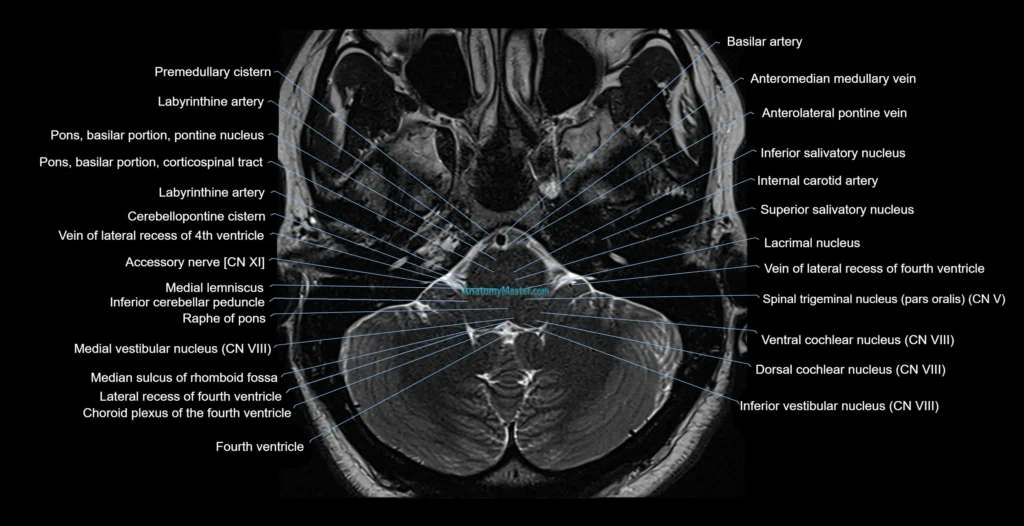 Brainstem and Basal Ganglia MRI Axial Anatomy anatomy 3T MRI images