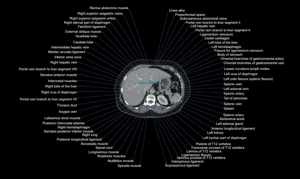 CT Abdomen axial cross sectional anatomy labelled radiology image