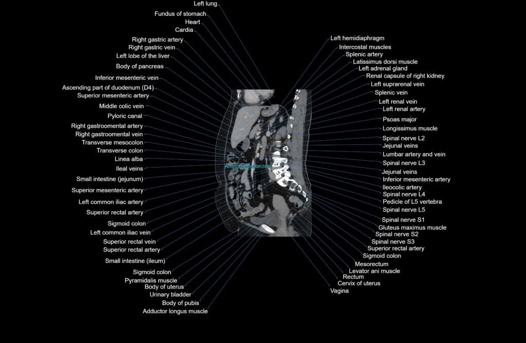 CT Abdomen sagittal cross sectional anatomy labelled radiology image