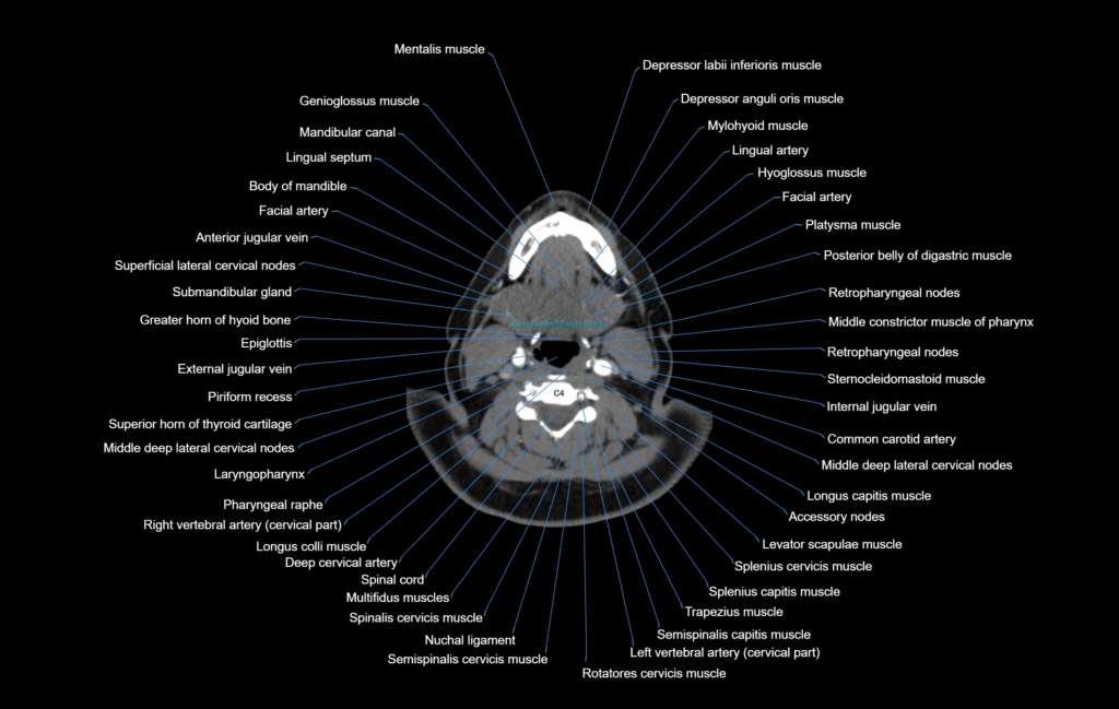 CT Neck axial cross sectional anatomy radiology image