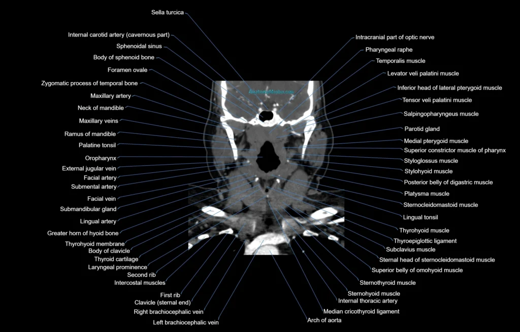 CT Neck coronal cross sectional anatomy labelled 3D radiology image