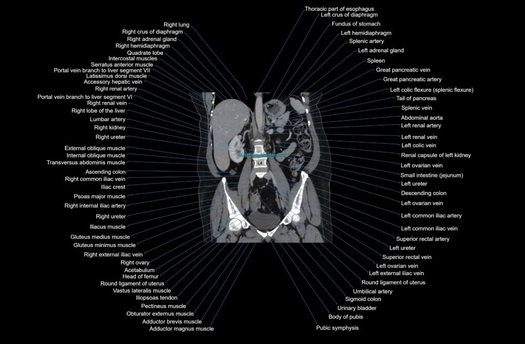 CT abdomen coronal cross sectional anatomy radiology image