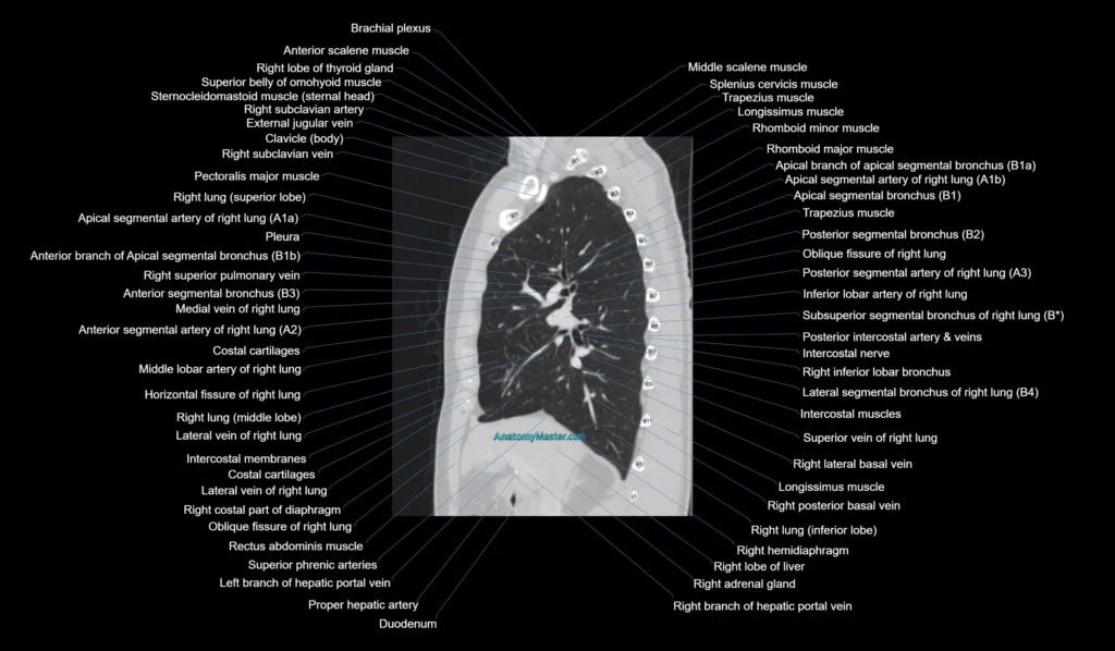 CT chest (thorax) labelled sagittal cross sectional anatomy radiology image