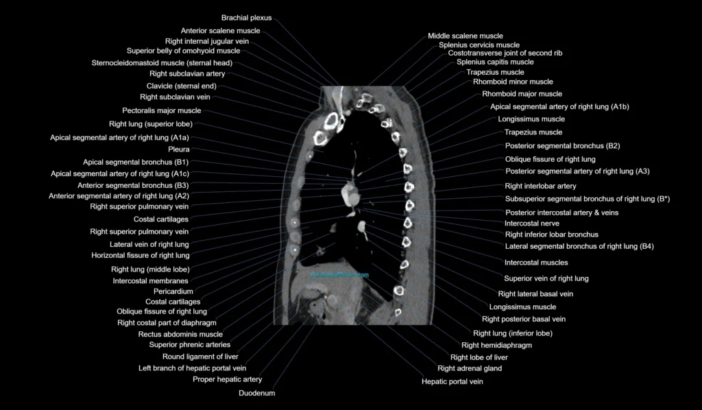 CT chest (thorax) labelled sagittal cross sectional anatomy radiology image