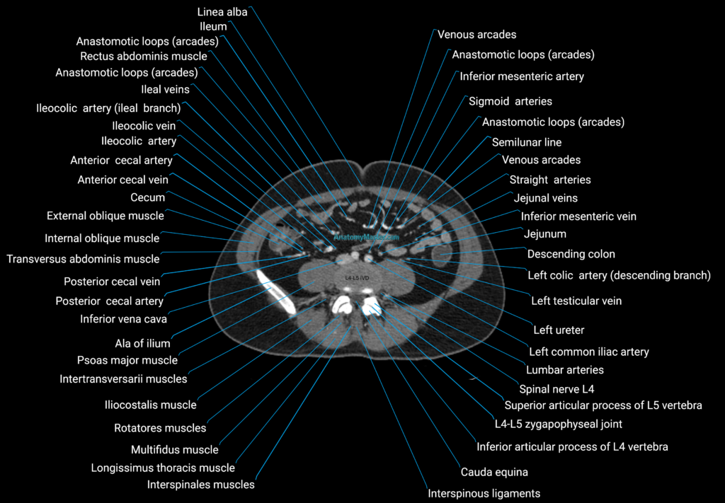 CT male pelvis axial cross sectional anatomy labelled radiology image