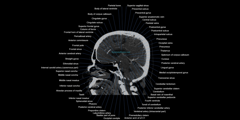 CT scan brain sagittal cross sectional anatomy image
