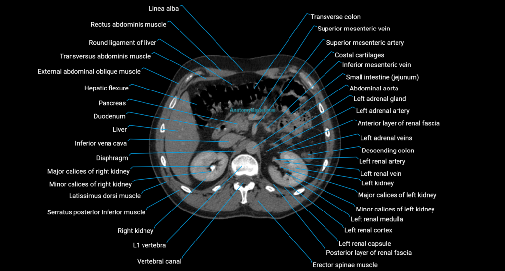 CT urogram axial axial cross sectional anatomy enchanced radiology image