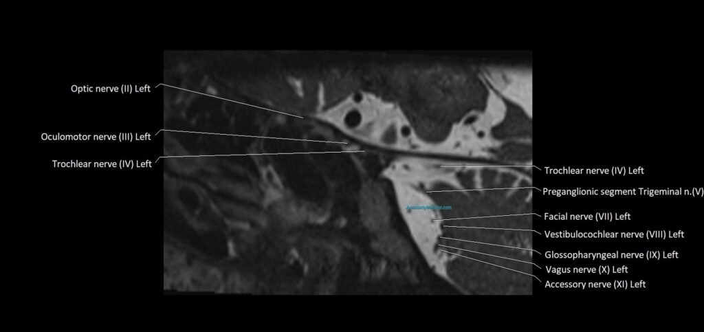 Cranial nerve sagittal anatomy MRI 3T image