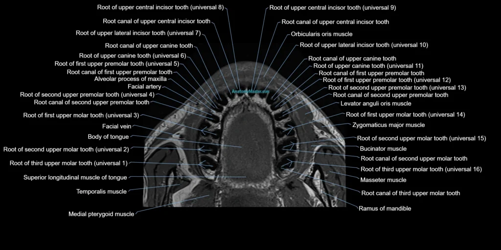 Dental MRI( tooth) axial labelled cross sectional 3T anatomy