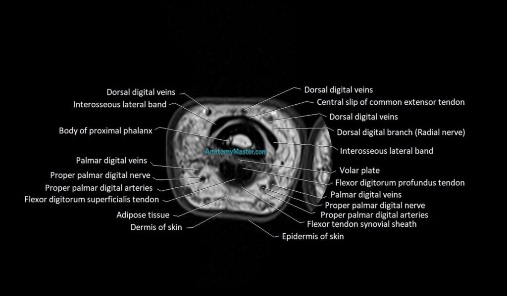 Finger anatomy axial cross sectional 3T image image