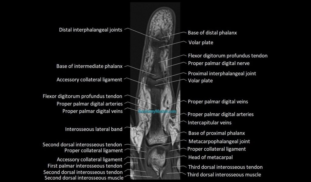 Finger anatomy coronal cross section 3T image