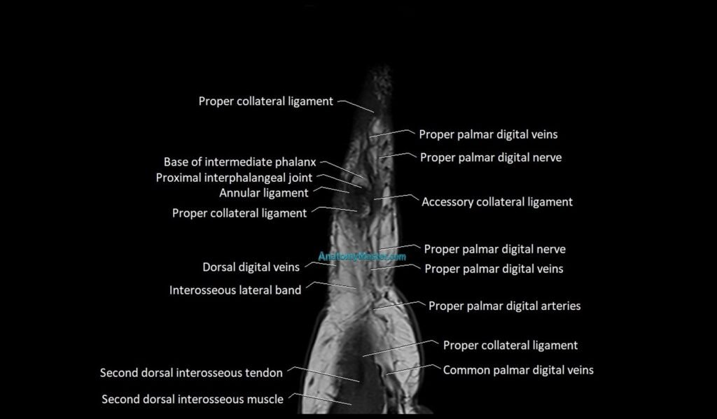 Finger anatomy sagittall cross section 3T image